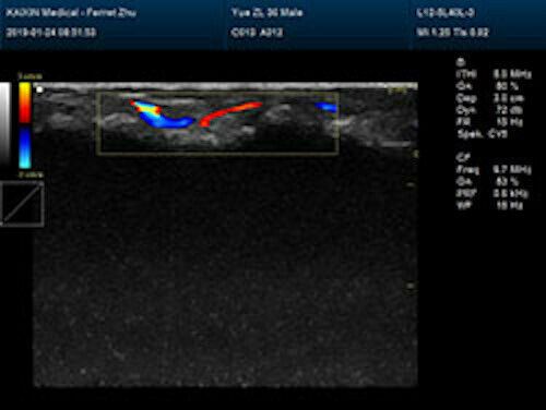 Quality Large Animal Veterinary Color Doppler Ultrasound & Micro convex Probe DIAGNOSTIC ULTRASOUND MACHINES FOR SALE