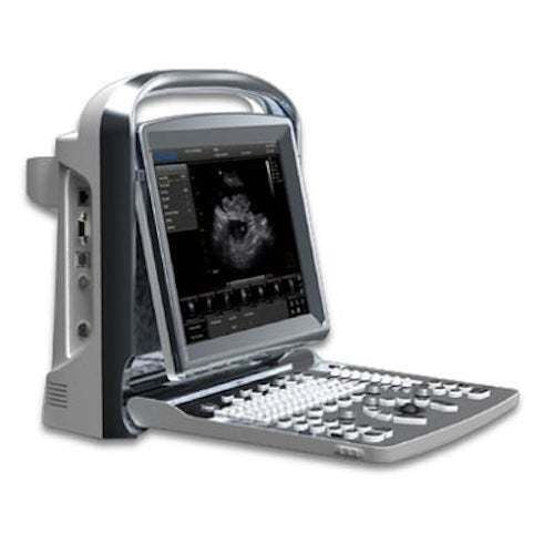 Chison ECO1 Portable LED Ultrasound Scanner two probes Convex & linear array DIAGNOSTIC ULTRASOUND MACHINES FOR SALE