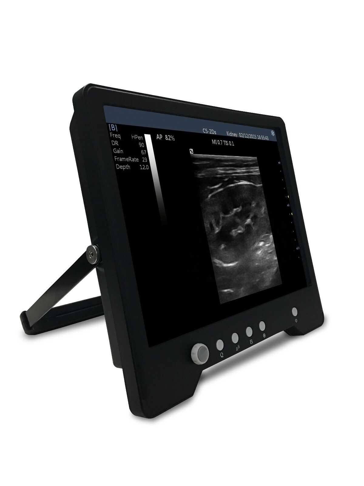 Veterinario Touchscreen Ultrasoundµ-convex Sonda per S Animali, Keebomed DIAGNOSTIC ULTRASOUND MACHINES FOR SALE