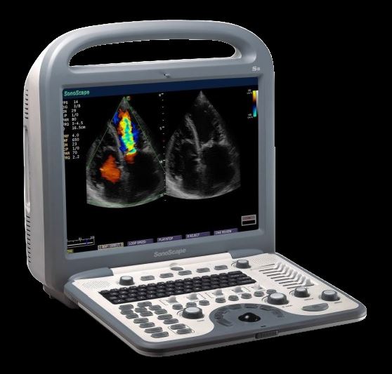 SonoScape S8 with L743 Linear array Probe Included - Used DIAGNOSTIC ULTRASOUND MACHINES FOR SALE