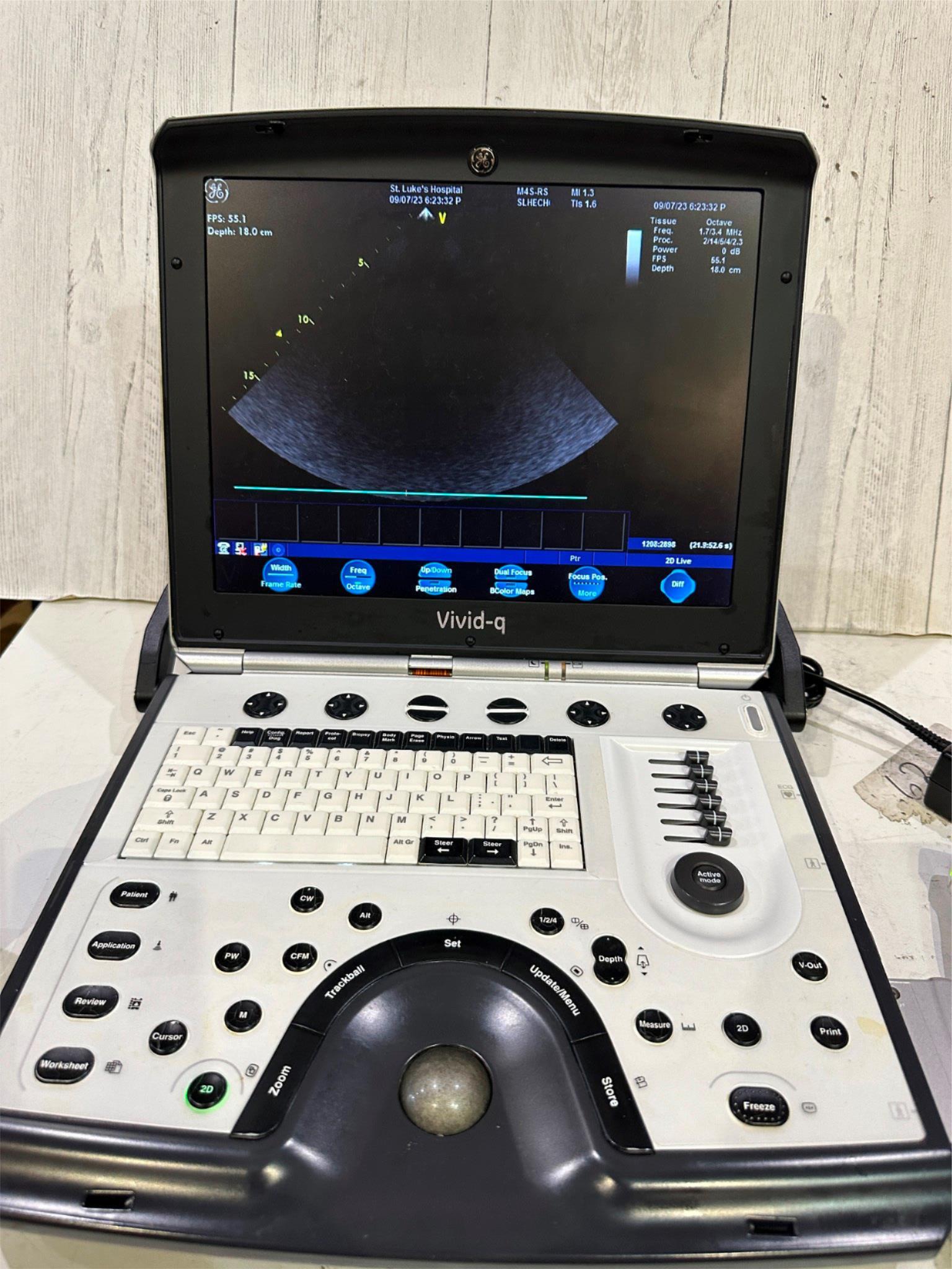 GE VIVID Q PORTABLE ULTRASOUND MACHINE BT12 -2015 DIAGNOSTIC ULTRASOUND MACHINES FOR SALE