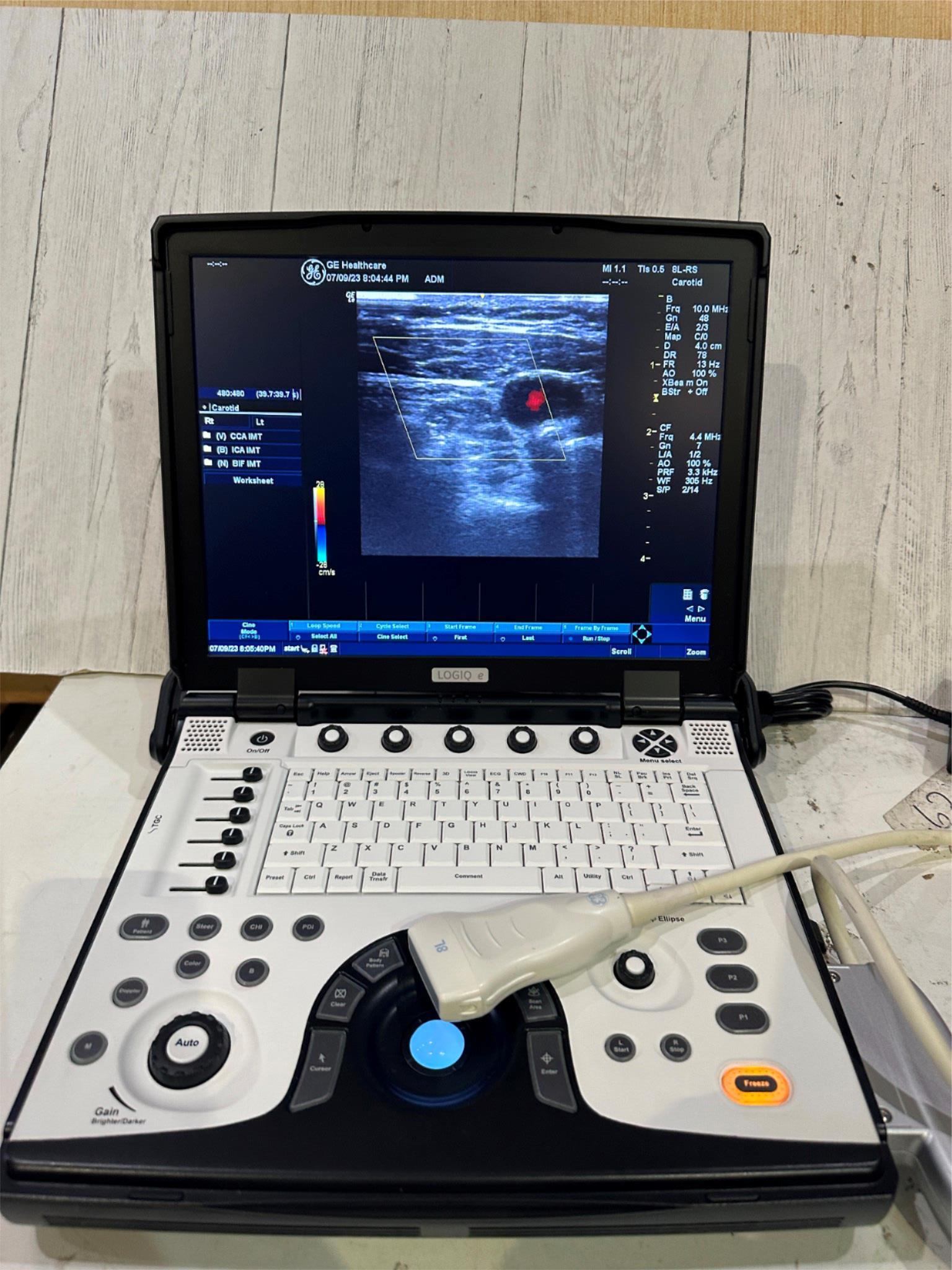 BT12 GE LOGIQ E Next Ge Ultrasound 2013, Vascular,OBGYN, MSK DIAGNOSTIC ULTRASOUND MACHINES FOR SALE