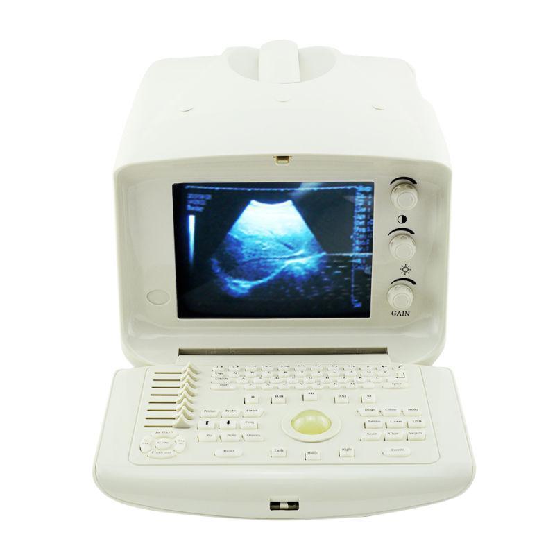 Ultrasonic scanner Portable Ultrasound Scanner Machine Micro-Convex Probe 3D A+ DIAGNOSTIC ULTRASOUND MACHINES FOR SALE