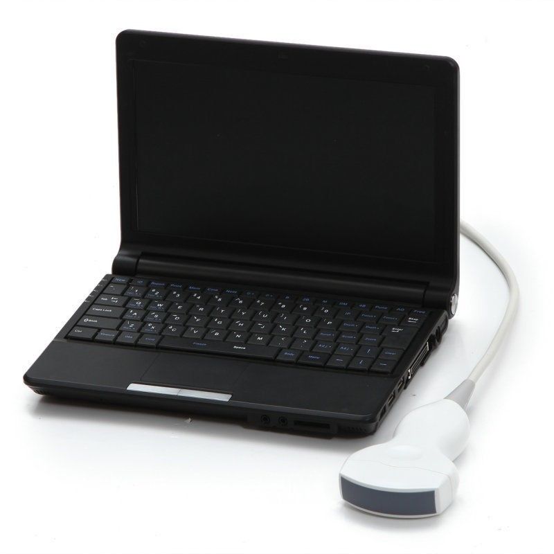 Laptop Ultrasound Scanner Machine Convex+micro convex Heart Pr+Linear 3D 3 Probe 190891055842 DIAGNOSTIC ULTRASOUND MACHINES FOR SALE