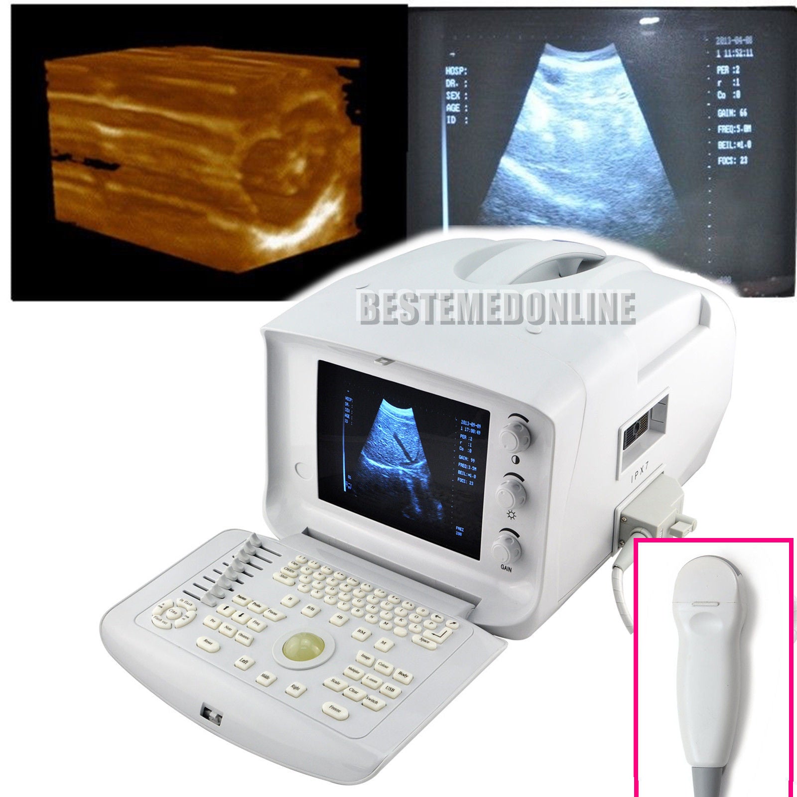Digital Ultrasound Scanner Micro-Convex Probe Ultrasonic Machine 3D Sonogram CE DIAGNOSTIC ULTRASOUND MACHINES FOR SALE