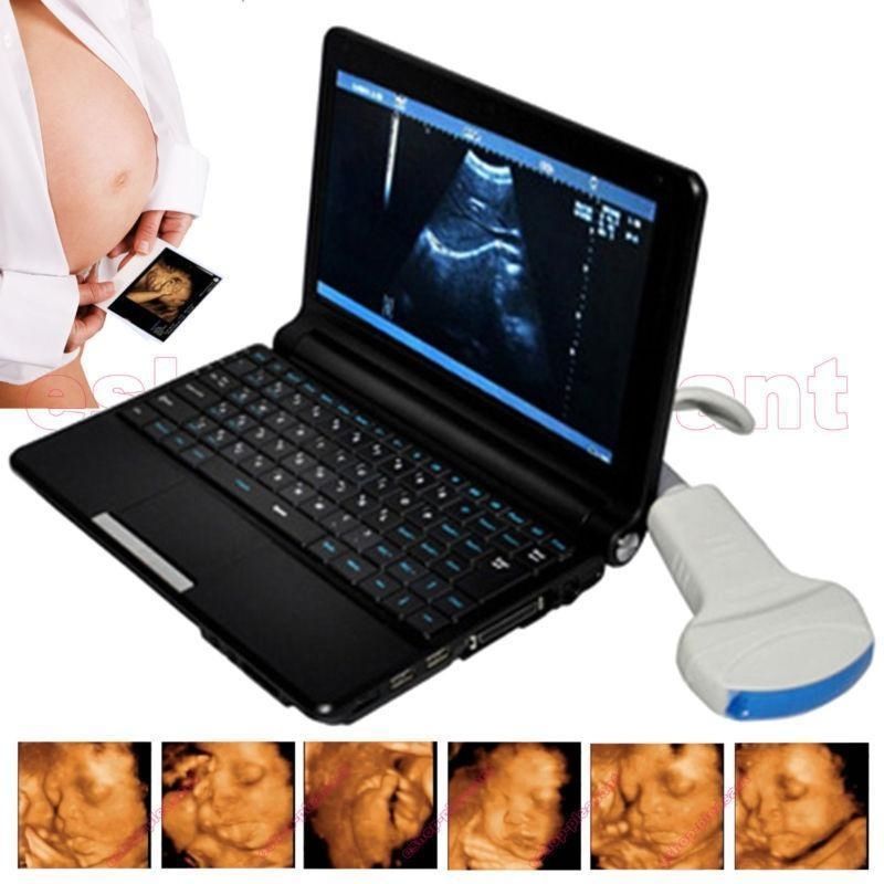 Laptop Portable Ultrasound Scanner Machine 3.5Mhz Convex probe/Sensor 3D& Gift 190891916501 DIAGNOSTIC ULTRASOUND MACHINES FOR SALE