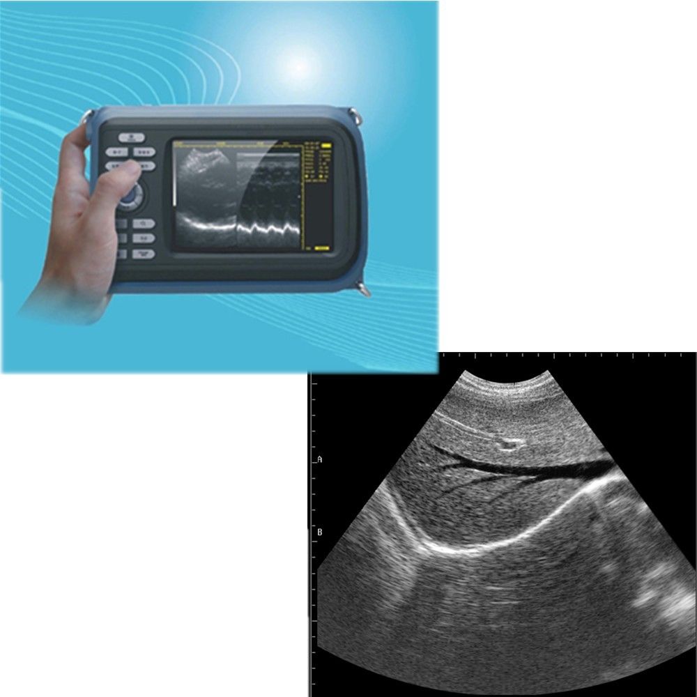 Laptop Ultrasound Scanner Machine System Convex Probe Abdominal Pregnancy Test 190891827272 DIAGNOSTIC ULTRASOUND MACHINES FOR SALE
