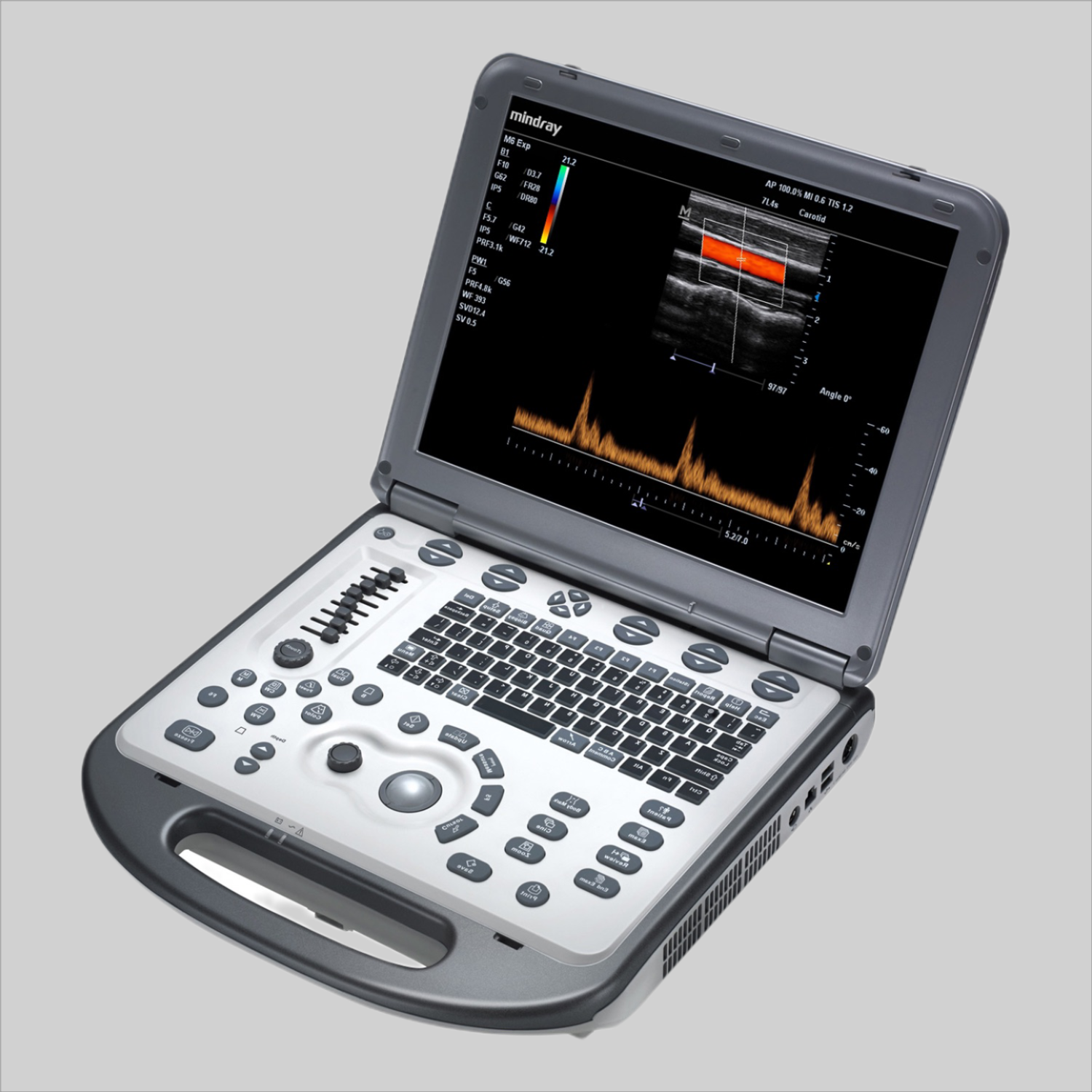 Mindray M6 Color doppler Ultrasound with 3 probes 2018 with cart DIAGNOSTIC ULTRASOUND MACHINES FOR SALE