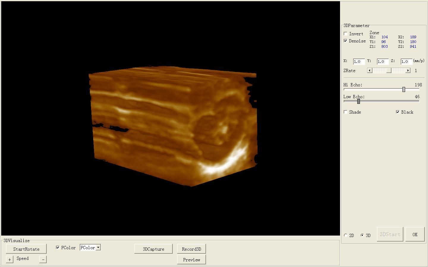 Digital Portable Ultrasound Scanner Machine + Convex & Transvaginal 2 Probes DHL DIAGNOSTIC ULTRASOUND MACHINES FOR SALE