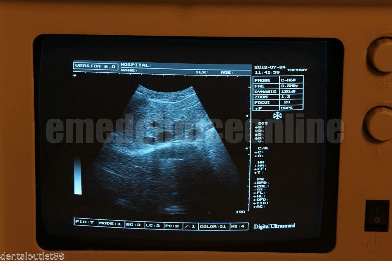 SALE 20% OFF!Ultrasound Machine Ultrasound Scanner with transvaginal probe +3D 190891893895 DIAGNOSTIC ULTRASOUND MACHINES FOR SALE