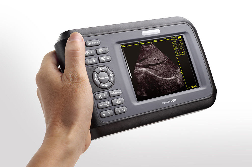 Handheld Ultrasound Scanner Digital Machine w Linear Probe Free Box & Battery 190891515230 DIAGNOSTIC ULTRASOUND MACHINES FOR SALE