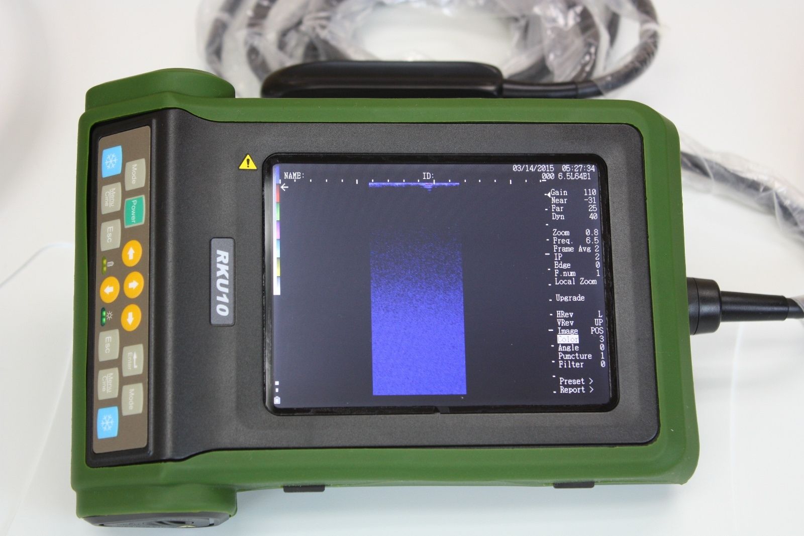 KeeboMed RKU-10 Veterinary Ultrasound Machine - Large Animals with Rectal Probe DIAGNOSTIC ULTRASOUND MACHINES FOR SALE