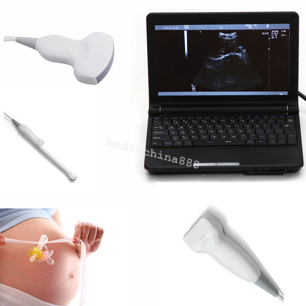 Laptop Ultrasound Scanner +Convex+Linear+Transvaginal 3 Probes Free Aluminum Box DIAGNOSTIC ULTRASOUND MACHINES FOR SALE