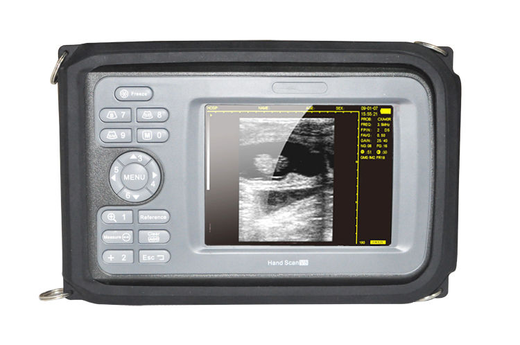 Handheld Smart Ultrasound Scanner Machine +Micro-Convex Probe w Box VET Aminal 190891596901 DIAGNOSTIC ULTRASOUND MACHINES FOR SALE