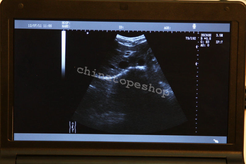 Laptop Machine Ultrasound scanner Transvaginal probe 3D Worksation + Case 190891297143 DIAGNOSTIC ULTRASOUND MACHINES FOR SALE