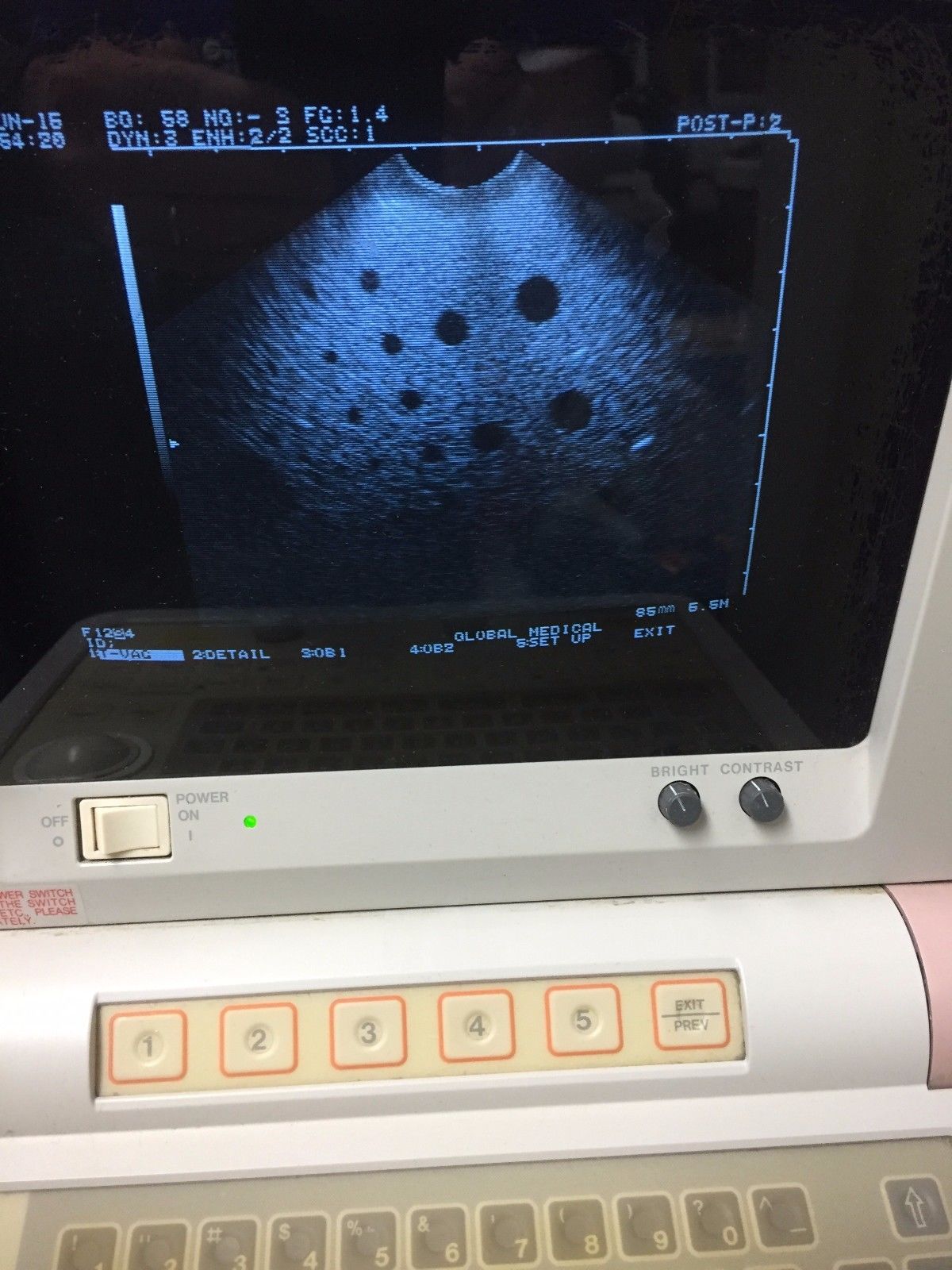 Hitachi EUP-V33 intercavity Ultrasound Probe / Has some dropout. DIAGNOSTIC ULTRASOUND MACHINES FOR SALE