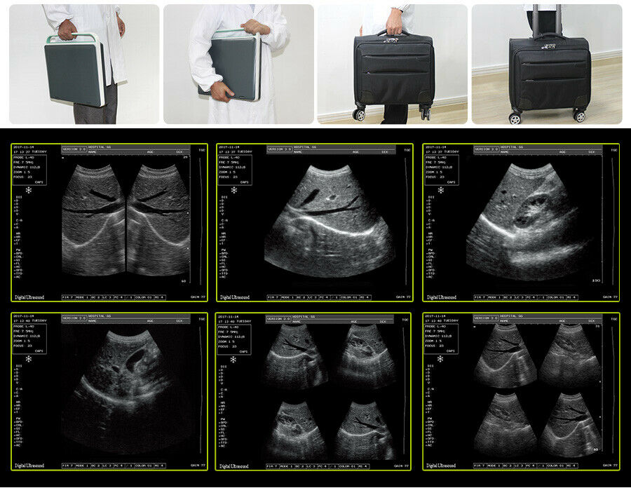 Portable Veterinary Ultrasound with Micro Convex probe DIAGNOSTIC ULTRASOUND MACHINES FOR SALE