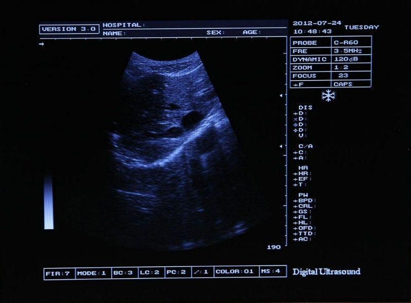 NEW Full Digital Portable Ultrasound Scanner with Transvaginal Probe 3D Software 190891050977 DIAGNOSTIC ULTRASOUND MACHINES FOR SALE