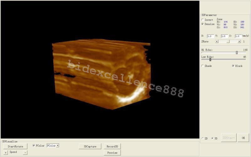 Ultrasound Machine Scanner System Linear Probe + Oximeter Portable Machine CE DIAGNOSTIC ULTRASOUND MACHINES FOR SALE