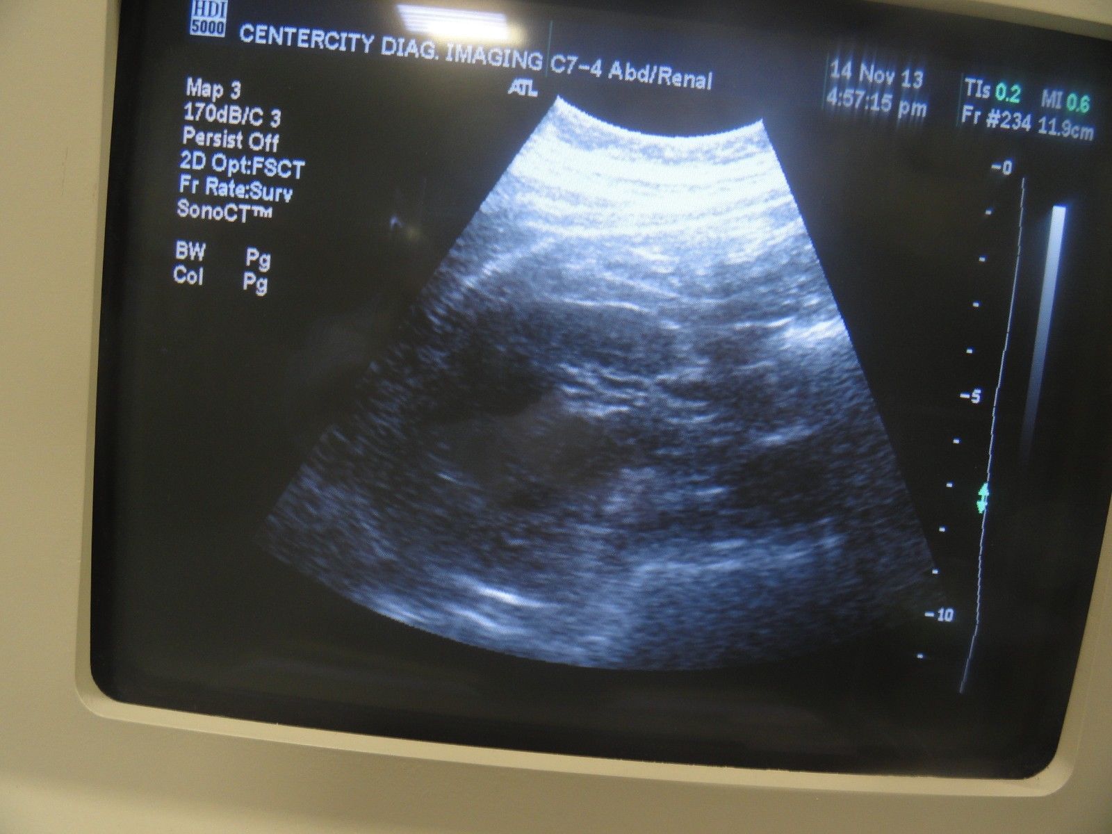 ATL C7-4 40R Curved Array Convex Abdominal Probe for ATL HDI Series (5965 ) DIAGNOSTIC ULTRASOUND MACHINES FOR SALE