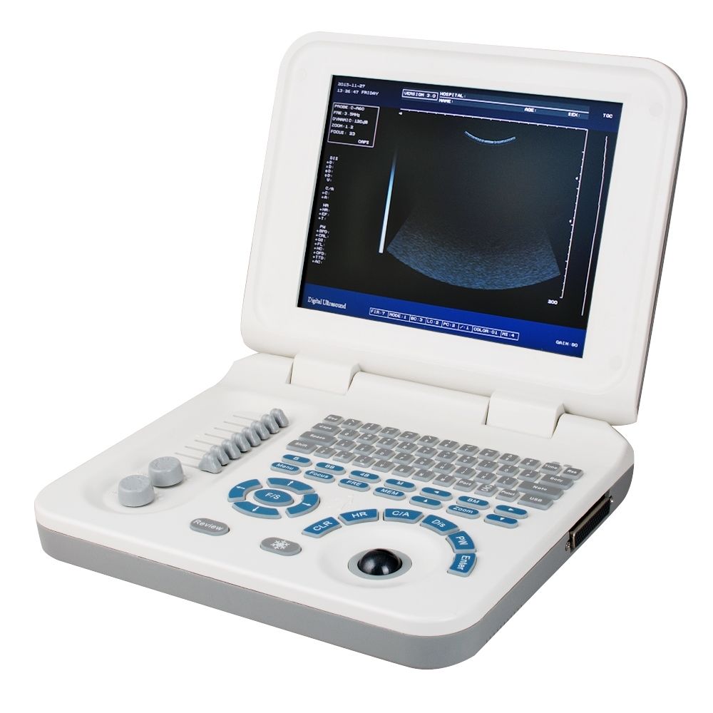 10" Portable Ultrasound Scanner Machine Micro-Convex Probe With Bag and Battery DIAGNOSTIC ULTRASOUND MACHINES FOR SALE
