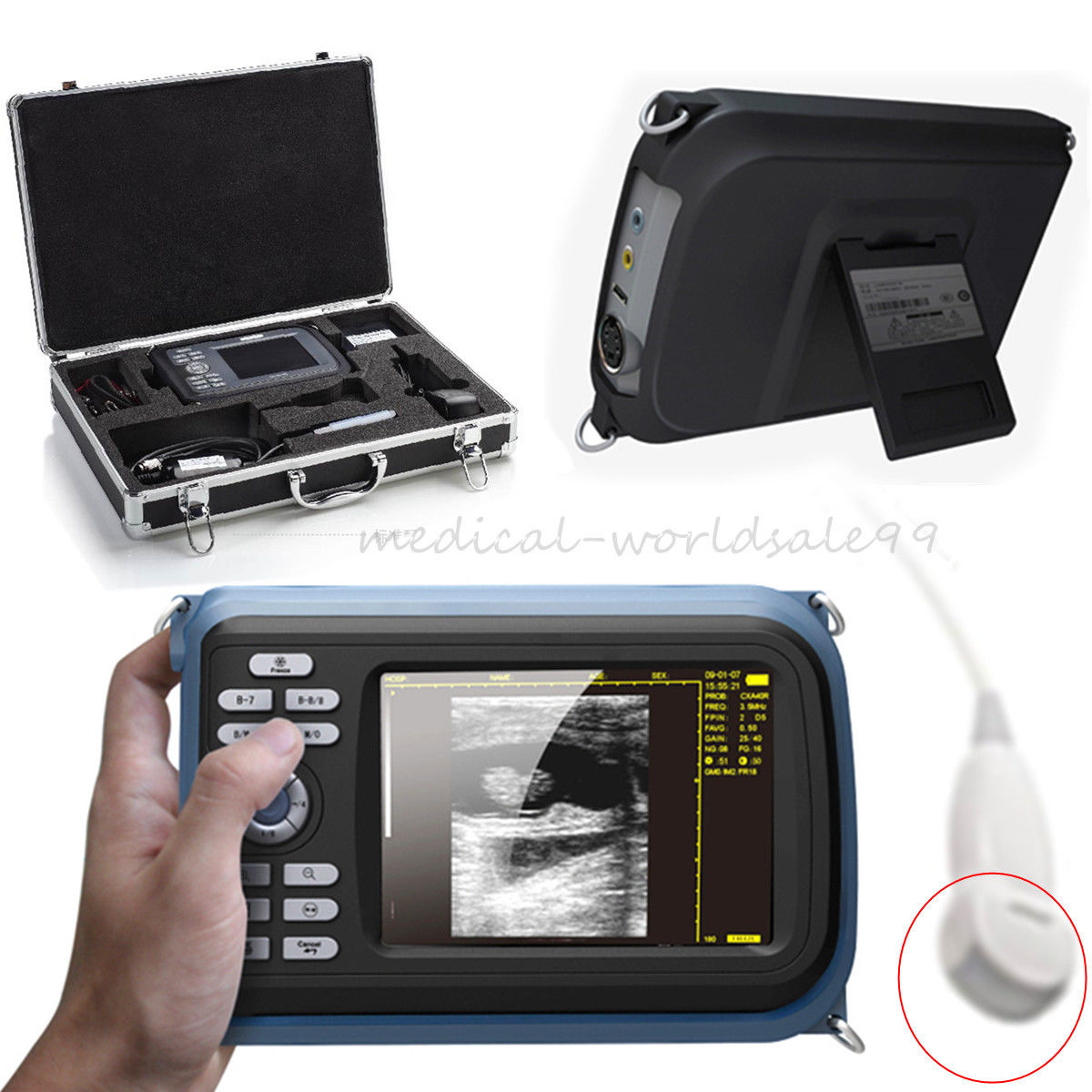 Handheld Ultrasound Scanner Machine Cardiac Micro-Convex Probe For Human Sale CE 190891435552 DIAGNOSTIC ULTRASOUND MACHINES FOR SALE