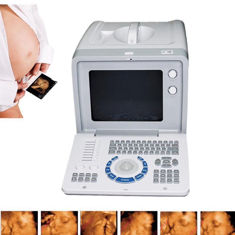 Portable Ultrasound Scanner Machine w Linear Probe +External 3D software 2018 CE 190891051035 DIAGNOSTIC ULTRASOUND MACHINES FOR SALE