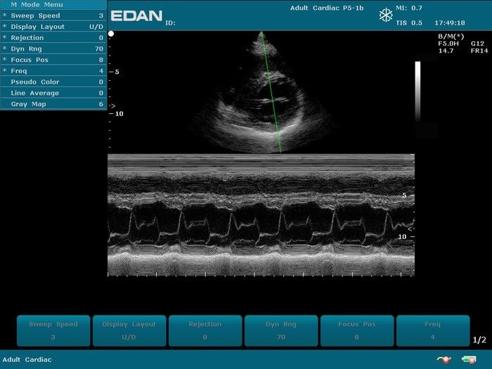 Edan U50 Prime Veterinary Ultrasound Machine. Microconvex & Phased Array Probes. DIAGNOSTIC ULTRASOUND MACHINES FOR SALE