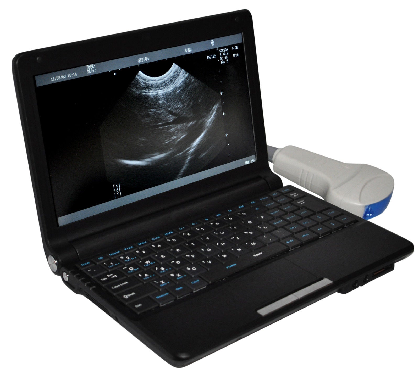 Digital Portable Ultrasound Machine Scanner System Convex Probe 3D + PR Oximeter DIAGNOSTIC ULTRASOUND MACHINES FOR SALE