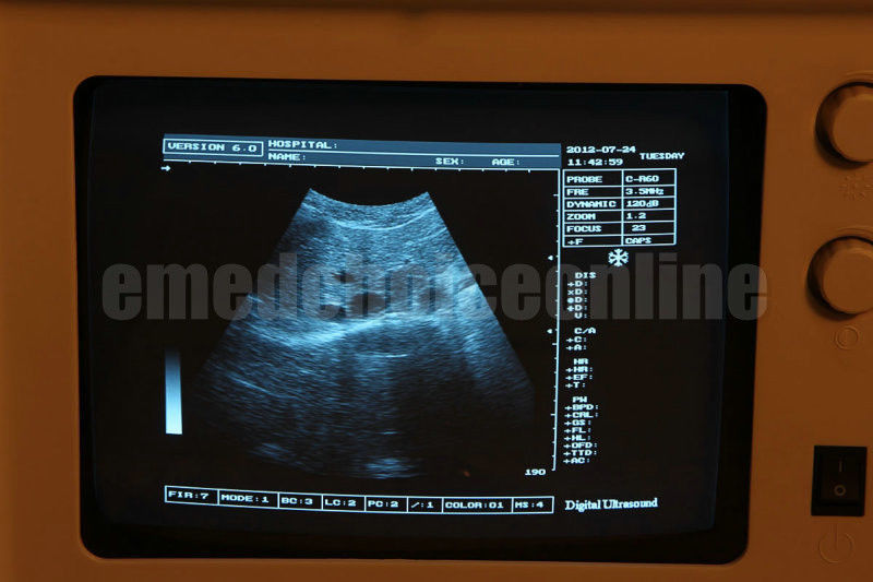 Portable LCD Digital Ultrasound Scanner System+ 6.5MHz Transvaginal Probe + 3D DIAGNOSTIC ULTRASOUND MACHINES FOR SALE
