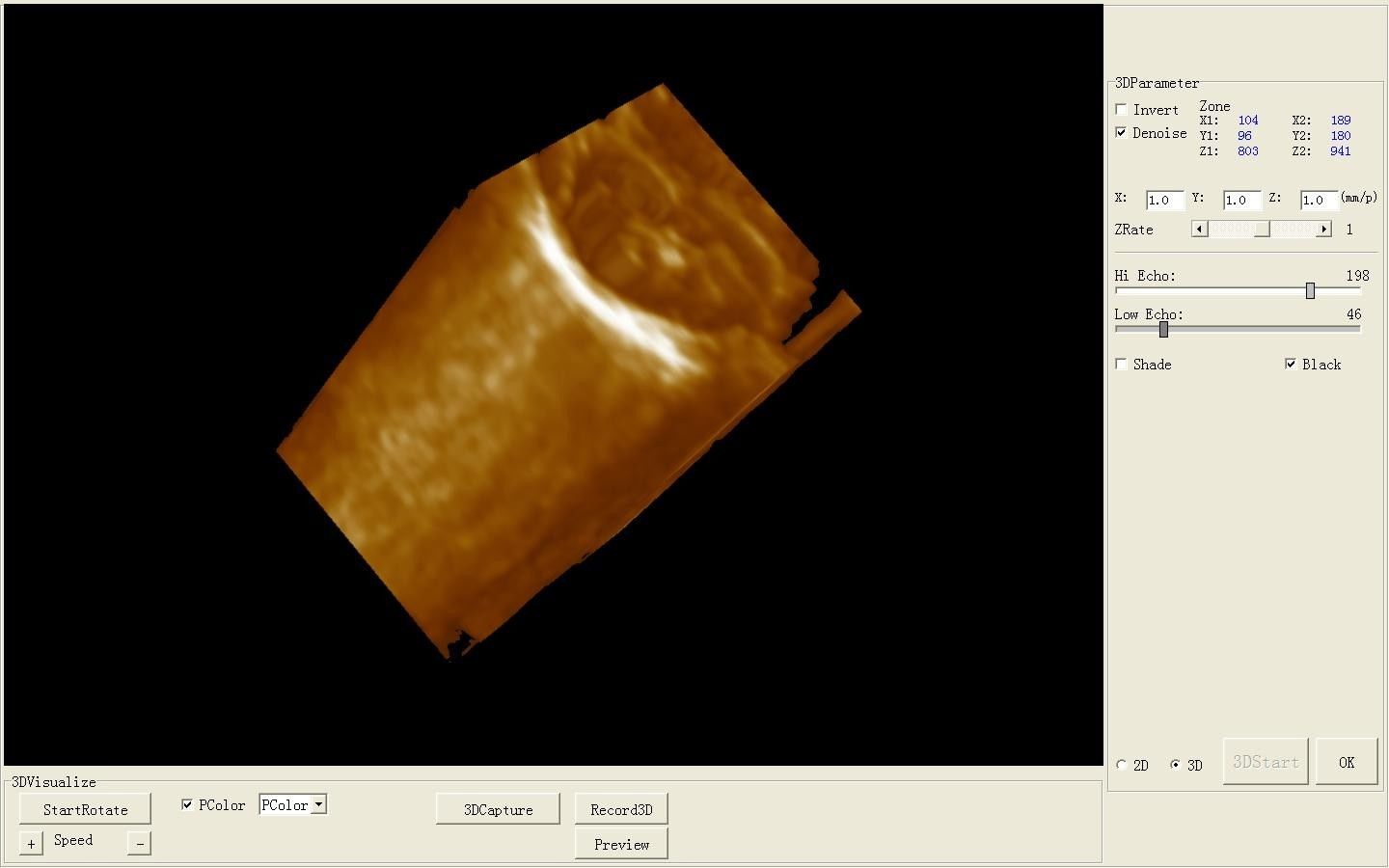 Medical Portable Notebook Laptop Ultrasound Scanner Digital 6.5Mhz Linear Probe 190891866813 DIAGNOSTIC ULTRASOUND MACHINES FOR SALE