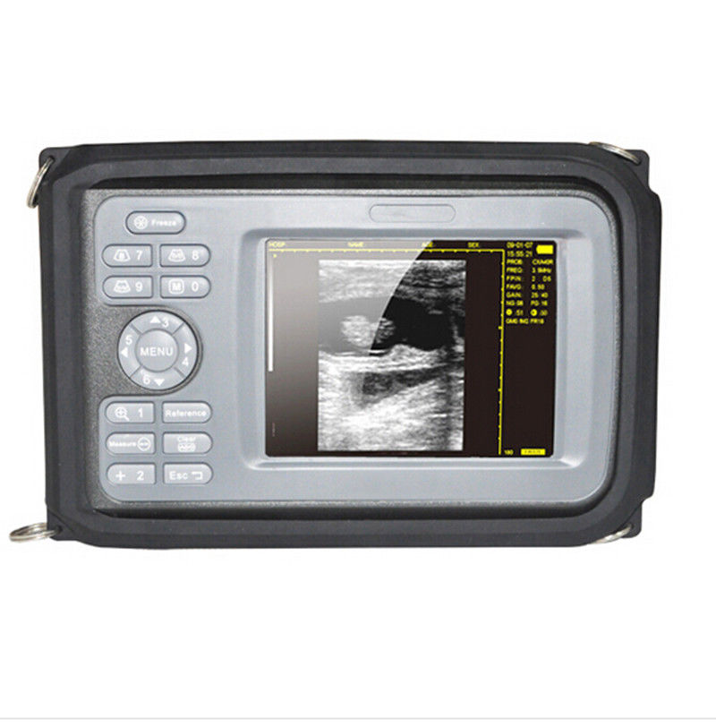 Handheld Ultrasound Scanner Digital Machine w Linear Probe Free Box & Battery 190891515230 DIAGNOSTIC ULTRASOUND MACHINES FOR SALE