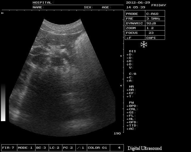 Medical Ultrasound Scanner Machine +7.5Mhz Linear Probe +3D Software 3 Years w 190891866943 DIAGNOSTIC ULTRASOUND MACHINES FOR SALE
