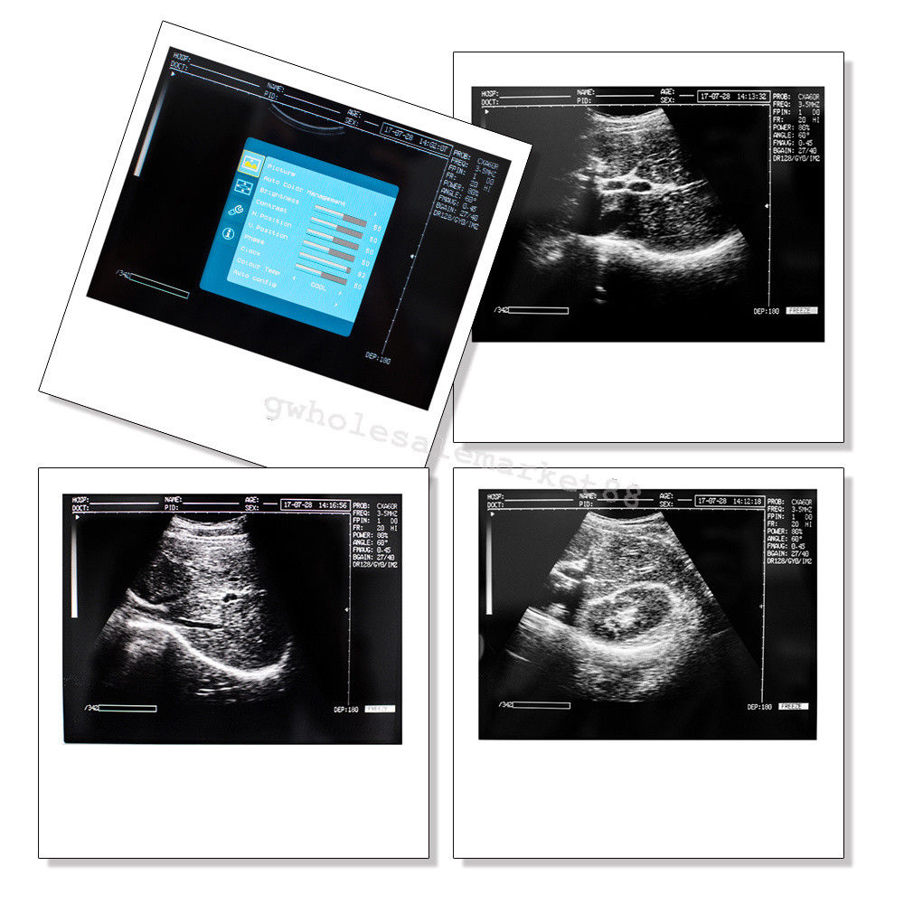 Laptop Ultrasound Machine Scanner Convex Probe 3D Software Clear Medical Clinic 190891045898 DIAGNOSTIC ULTRASOUND MACHINES FOR SALE