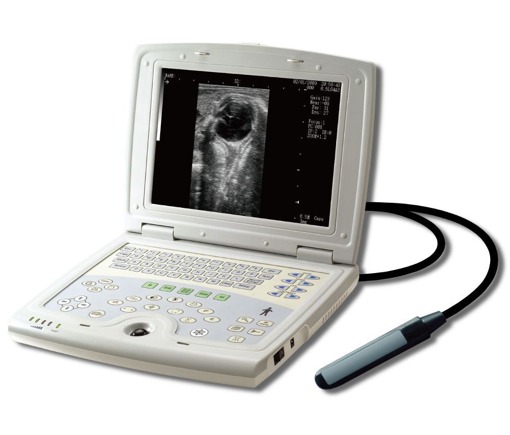Portable Digital Ultrasound Device, Farm Animals-Equine Bovine KeeboMed KX5000KV DIAGNOSTIC ULTRASOUND MACHINES FOR SALE
