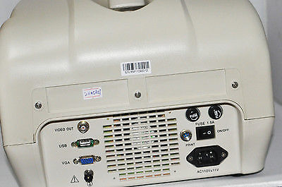 Portable ultrasound bladder scanner system Convex Transvaginal probe 3D Software DIAGNOSTIC ULTRASOUND MACHINES FOR SALE