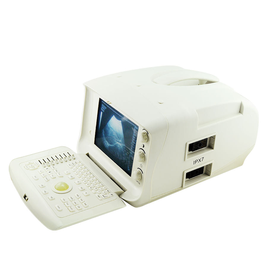 Portable Digital Ultrasound Scanner Machine System 5.0MHz Micro Convex Probe 3D 190891303288 DIAGNOSTIC ULTRASOUND MACHINES FOR SALE