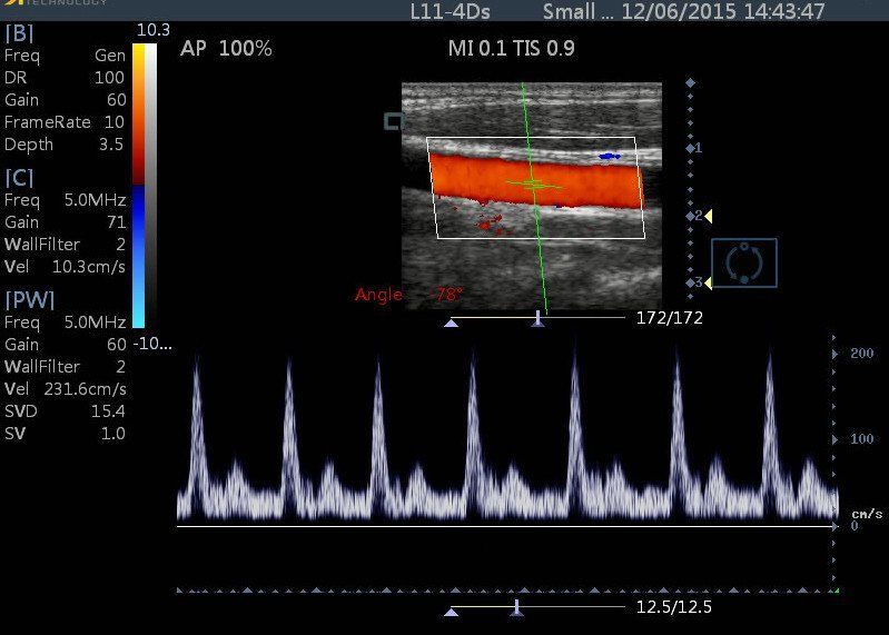 Veterinary Color Doppler Touch Screen Ultrasound 15" with Linear Array Probe DIAGNOSTIC ULTRASOUND MACHINES FOR SALE