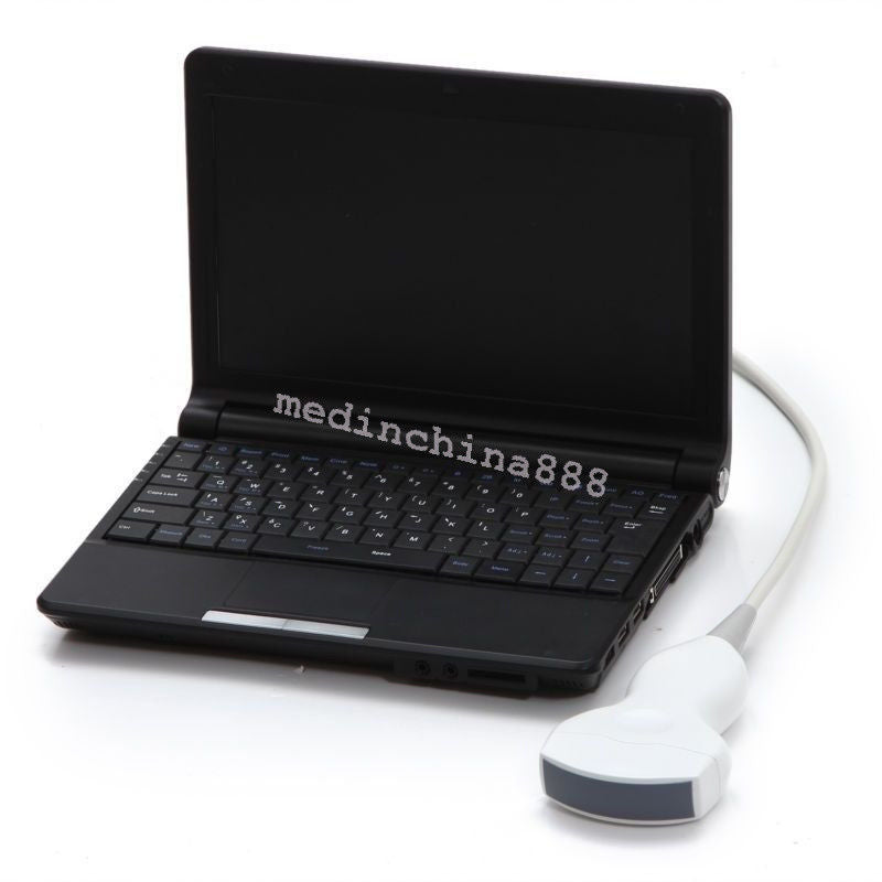 Digital LCD Ultrasound Scanner Machine+Convex + Linear Probe+Sony Printer 190891246417 DIAGNOSTIC ULTRASOUND MACHINES FOR SALE