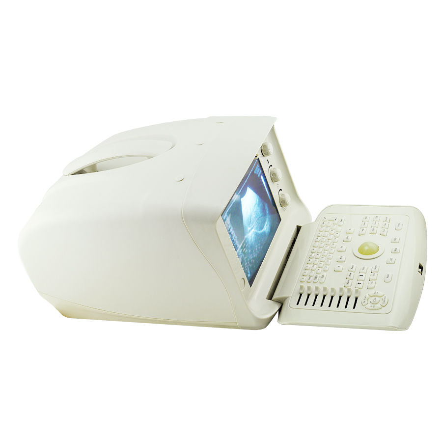 Portable Digital Ultrasound Scanner Machine System 5.0MHz Micro Convex Probe 3D 190891303288 DIAGNOSTIC ULTRASOUND MACHINES FOR SALE