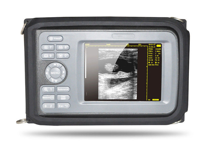 Portable Machine Digital Ultrasound Scanner System 5Mhz Micro-convex Heart Probe 190891055446 DIAGNOSTIC ULTRASOUND MACHINES FOR SALE