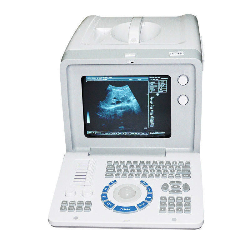 Diagnostic Ultrasound Scanner Machine Convex +Transvaginal Probe 3D Photo Check 190891665560 DIAGNOSTIC ULTRASOUND MACHINES FOR SALE