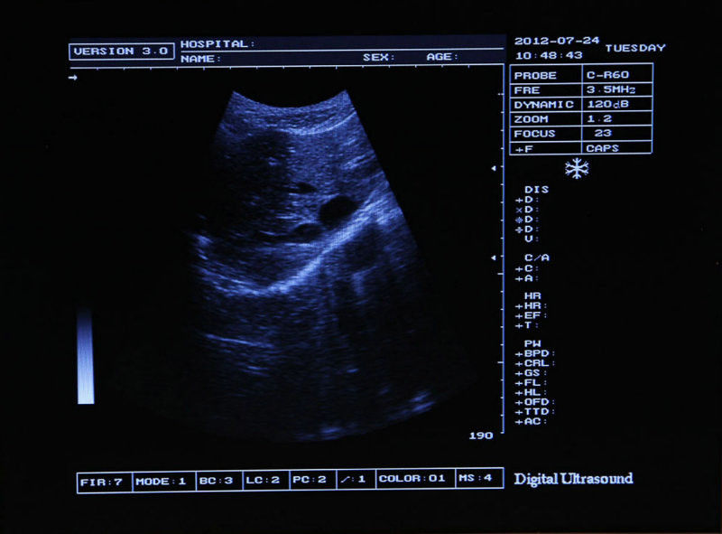 Portable 12'' SVGA LCD Digital Ultrasound Scanner System Convex Linear Probes 3D 190891802217 DIAGNOSTIC ULTRASOUND MACHINES FOR SALE