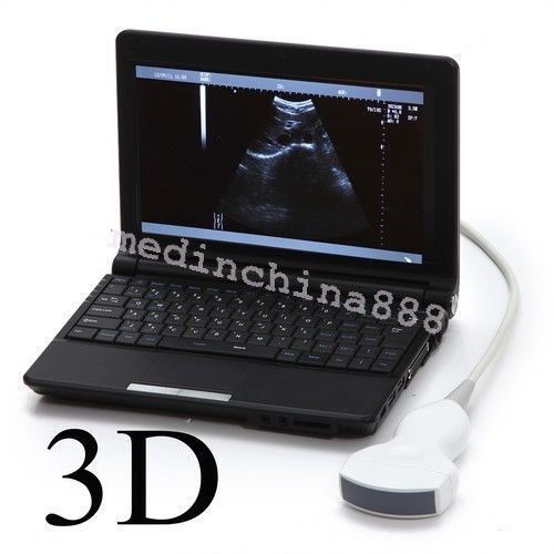 Digital LCD Ultrasound Scanner Machine+Convex + Linear Probe+Sony Printer 190891246417 DIAGNOSTIC ULTRASOUND MACHINES FOR SALE