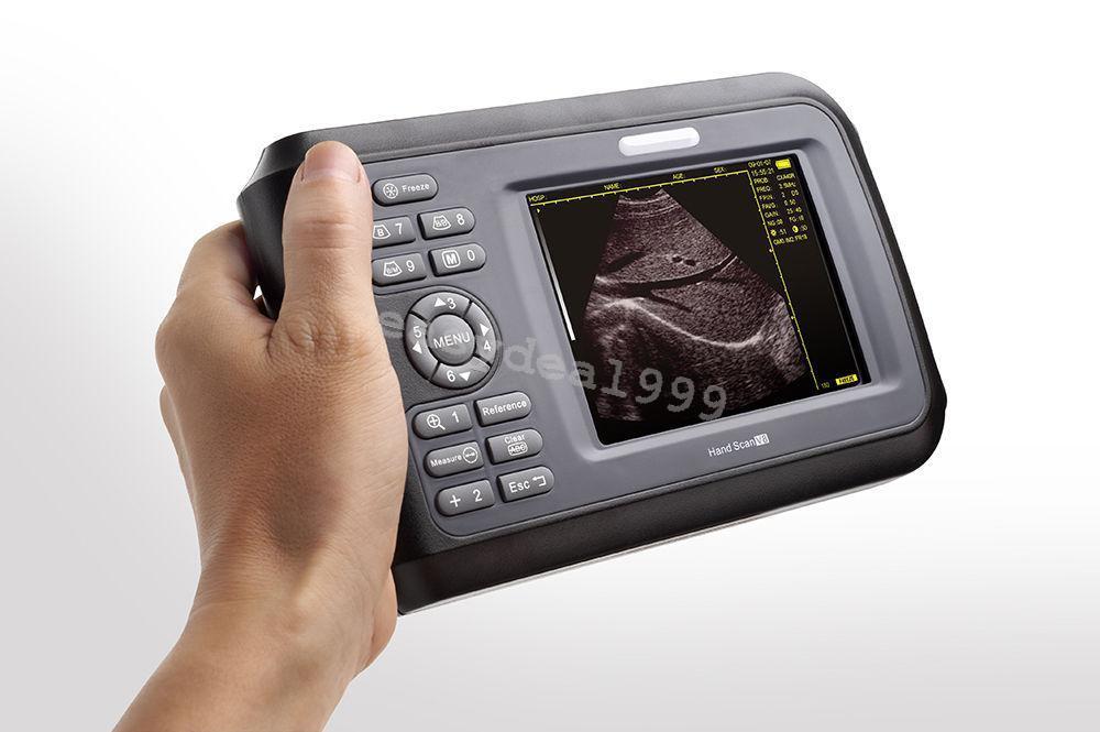 Portable Handheld Ultrasound Scanner + Transvaginal Probe + Rechargeable Battery DIAGNOSTIC ULTRASOUND MACHINES FOR SALE