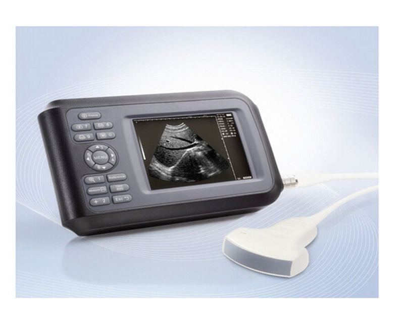 Digital LCD Smartscan Machine Ultrasound Scanner & Micro-convex Probe & Battery 190891411631 DIAGNOSTIC ULTRASOUND MACHINES FOR SALE