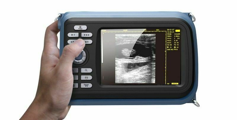 Portable Ultrasound Scanner/Machine Convex Transducer For Human 100% Warranty DIAGNOSTIC ULTRASOUND MACHINES FOR SALE