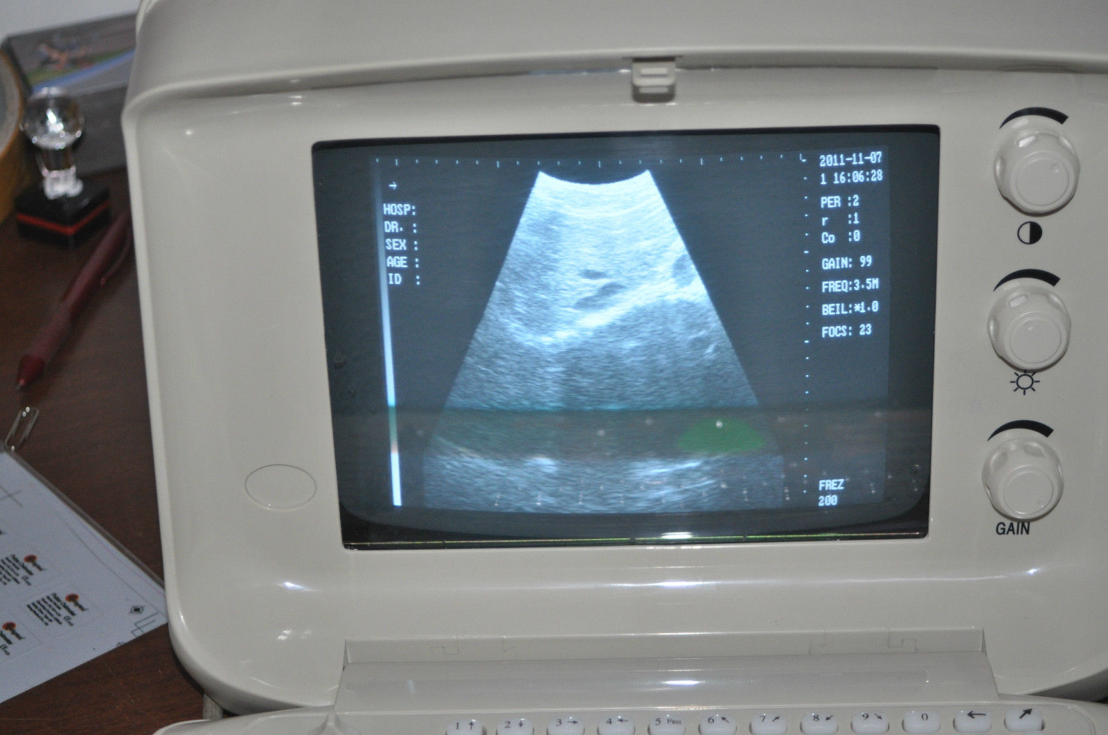 Portable Ultrasound Scanner w probe Convex+Micro convex heart Echo +3D software 190891057600 DIAGNOSTIC ULTRASOUND MACHINES FOR SALE