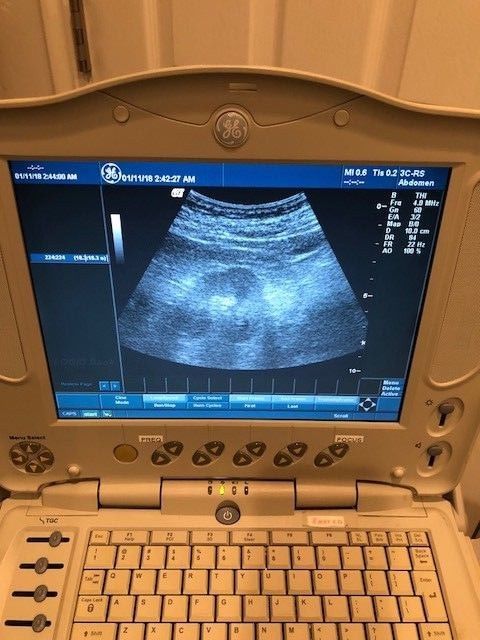 GE Logiq Book Portable Ultrasound  2004 DIAGNOSTIC ULTRASOUND MACHINES FOR SALE
