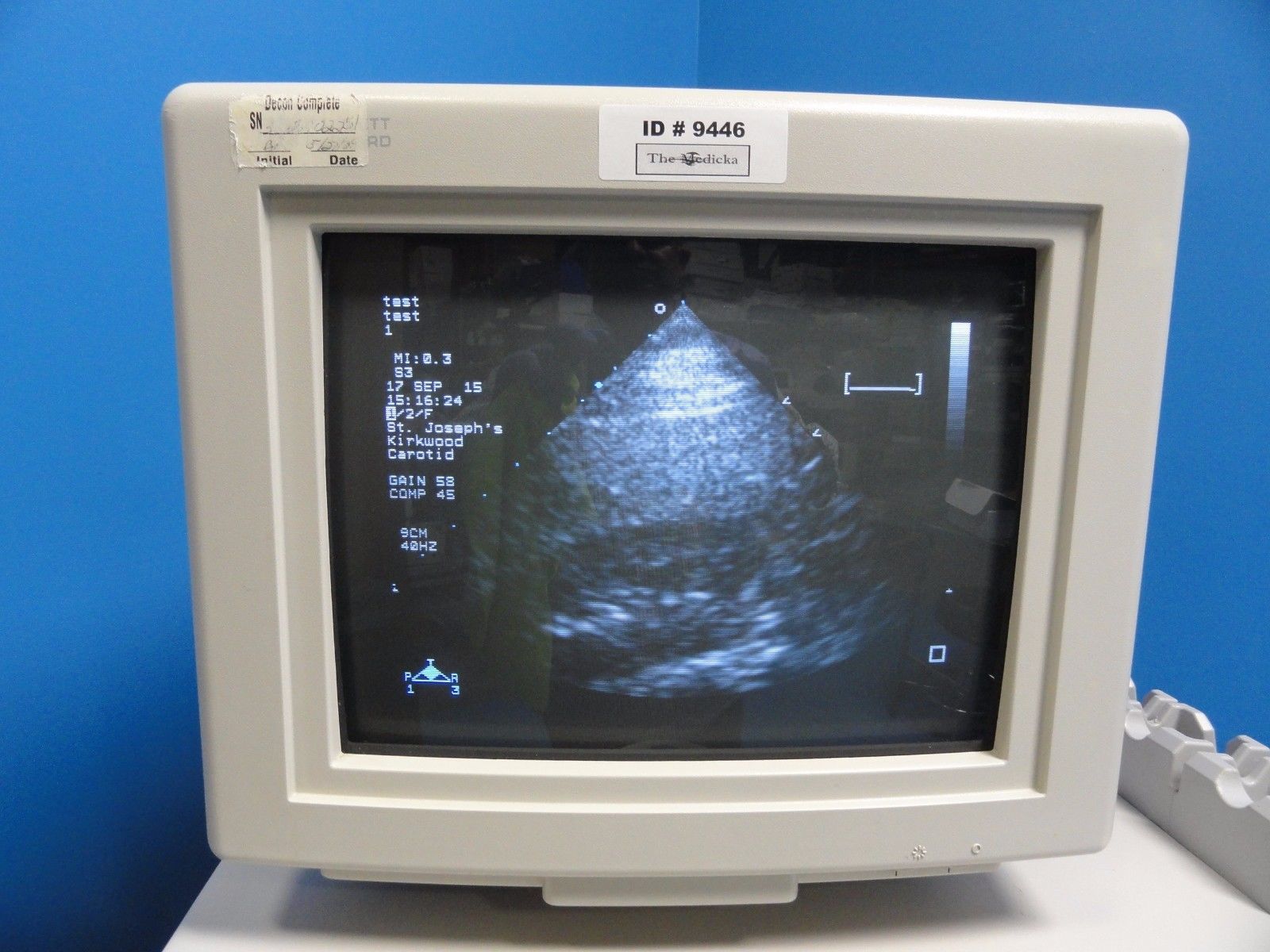 ulrasound monitor